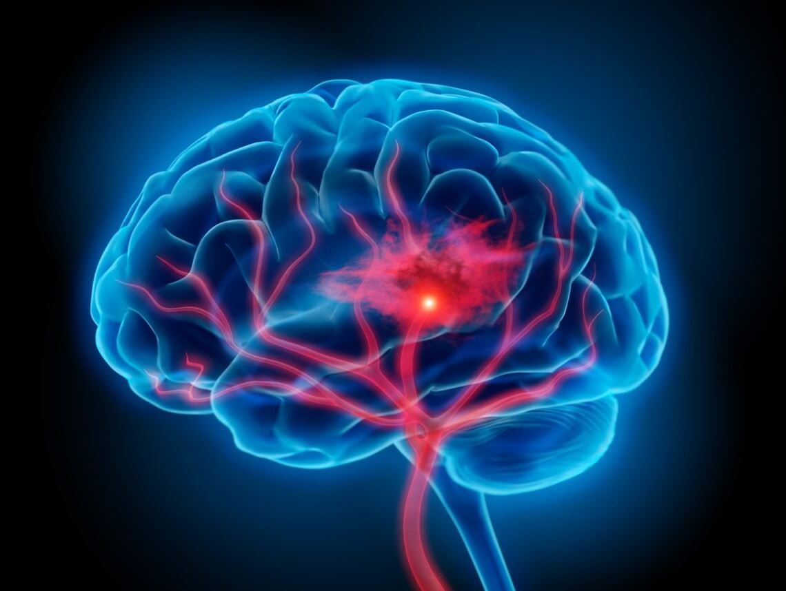 Hepatic Encephalopathy